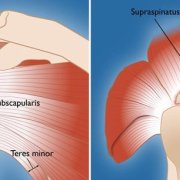 what-are-the-risks-and-complications-of-rotator-cuff-surgery.jpg What are the risks and complications of rotator cuff surgery?
