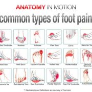 what-are-the-most-common-causes-of-foot-pain.jpg What are the most common causes of foot pain?