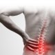 What are the risk factors for developing low back pain?
