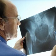 orthopaedic-health-in-the-news-current-events-and-research.jpg Orthopaedic Health in the News: Current Events and Research